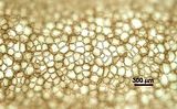6 – Cellule corticali in visione superficiale